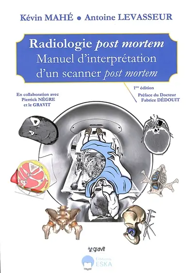 Radiologie post mortem : manuel d'interprétation d'un scanner post mortem