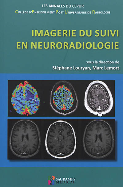 Imagerie du suivi en neuroradiologie