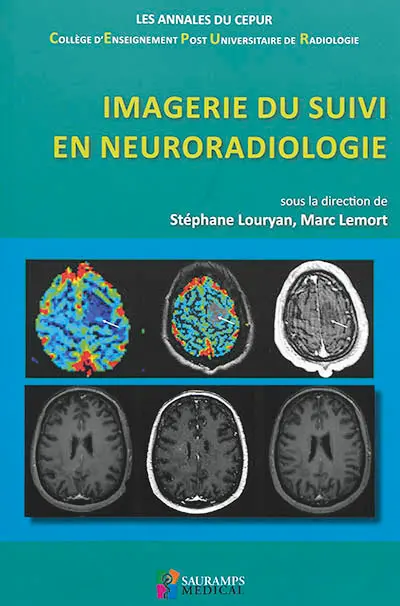 Imagerie du suivi en neuroradiologie