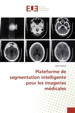 Plateforme de segmentation...