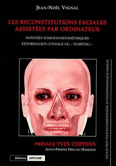 Les reconstitutions faciales assistées par ordinateur : données tomodensitométriques, déformation d'image ou warping