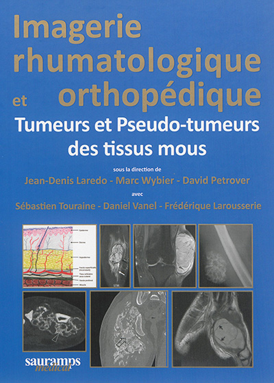 Imagerie rhumatologique et orthopédique. Vol. 5. Tumeurs et pseudo-tumeurs des tissus mous