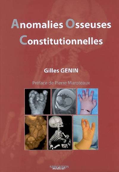 Anomalies osseuses constitutionnelles : démarche puridisciplinaire : obstétrique, pédiatrique, génétique, radiologique, chirurgicale et psychologique