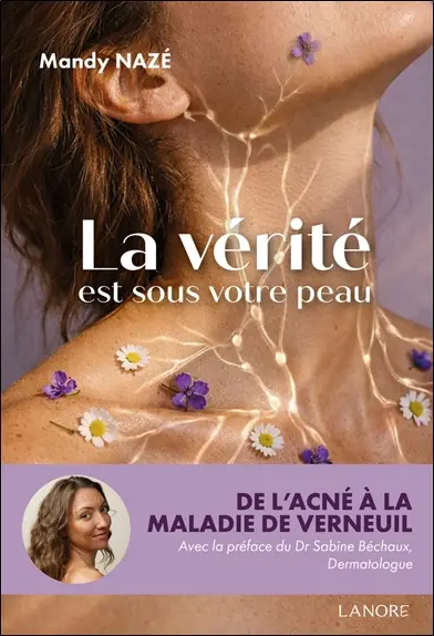 La vérité est sous votre peau : de l'acné à la maladie de Verneuil