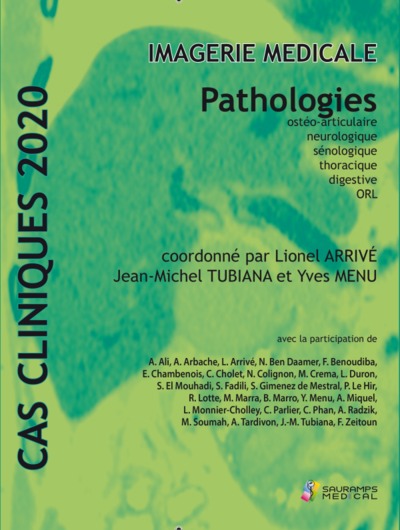 Imagerie médicale : pathologies ostéo-articulaire, neurologique, sénologique, thoracique, digestive, ORL : cas clinique 2020