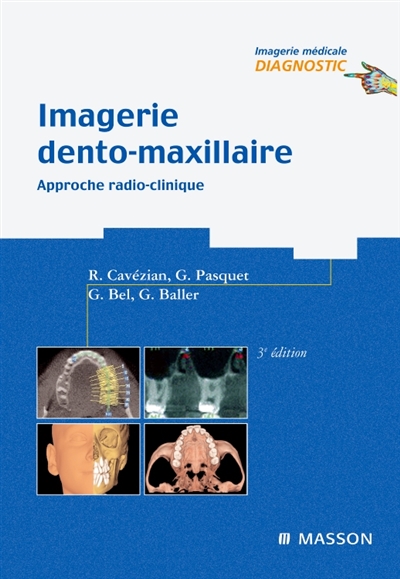 Imagerie dento-maxillaire : approche radio-clinique