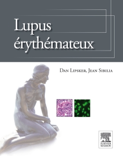 Lupus érythémateux
