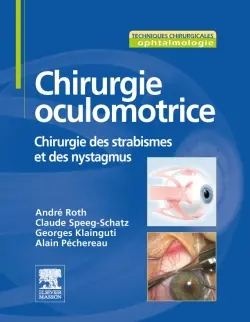 Chirurgie oculomotrice : chirurgie des strabismes et des nystagmus