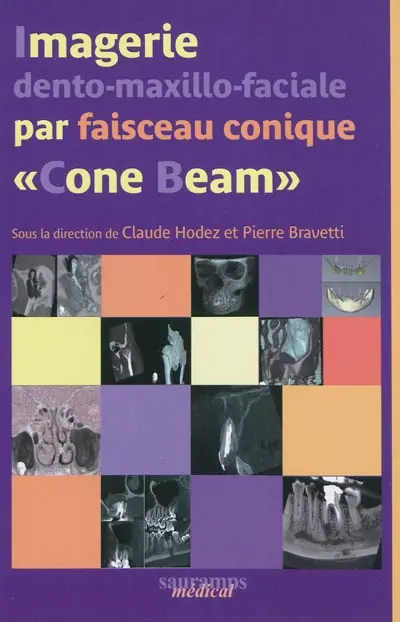 Imagerie dento-maxillo-faciale par faisceau conique Cone Beam : journée de Nancy du 13 mars 2010