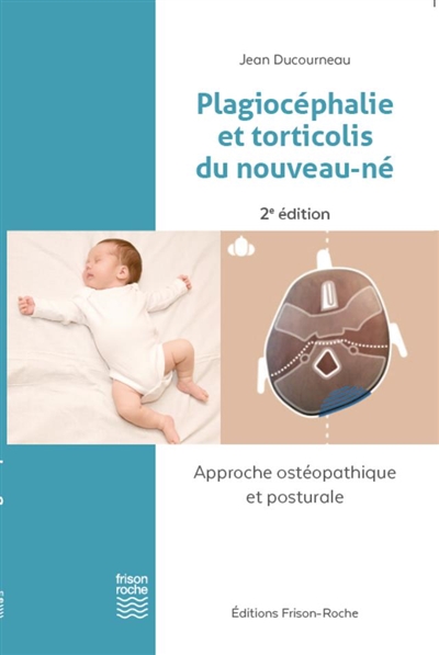 Plagiocéphalie et torticolis du nouveau-né : approche ostéopathique et posturale