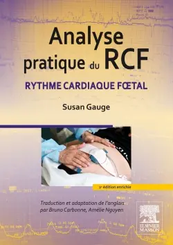 Analyse pratique du RCF : rythme cardiaque foetal