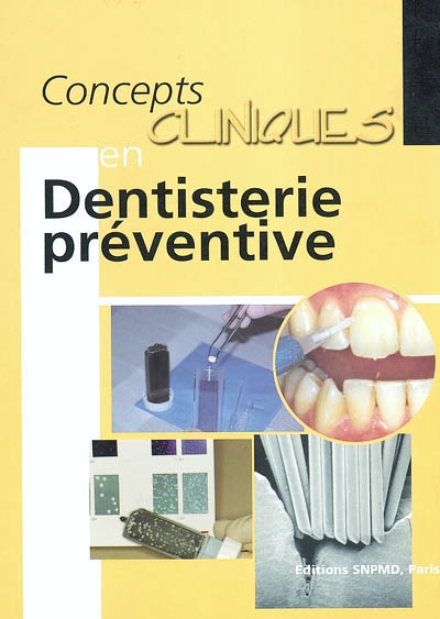 Concepts cliniques en dentisterie préventive