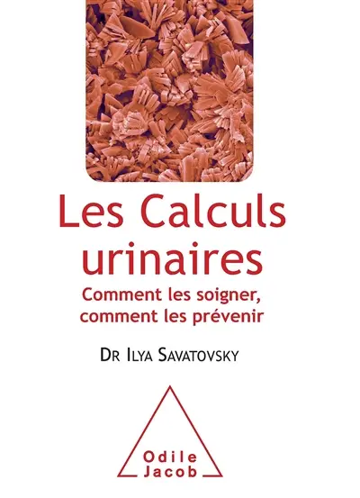 Les calculs urinaires : comment les soigner, comment les prévenir