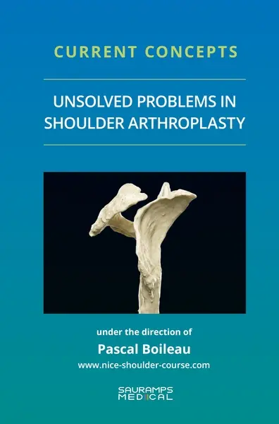 Unsolved problems in shoulder arthroplasty : current concepts Unsolved problems in shoulder arthroplasty : current concepts
