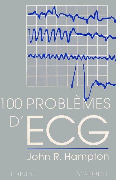 100 problèmes d'ECG