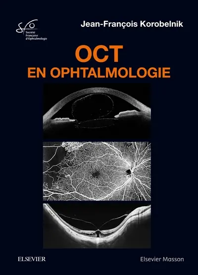 OCT en ophtalmologie : rapport 2019