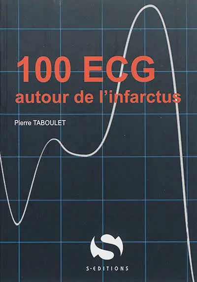 100 ECG autour de l'infarctus