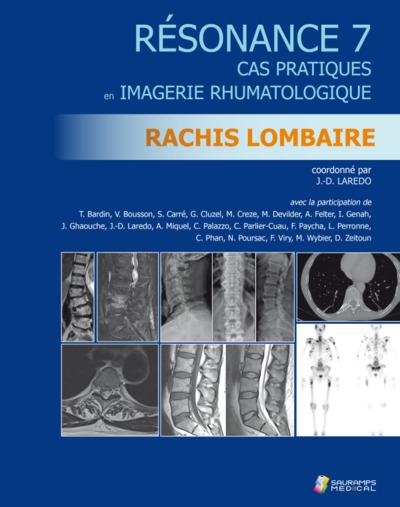 résonance : cas pratiques en imagerie rhumatologique. vol. 7. rachis lombaire