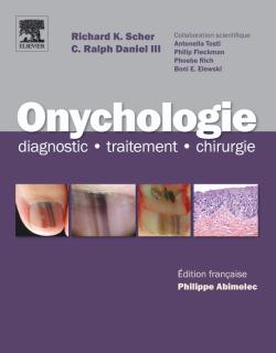 Onychologie : diagnostic, traitement, chirurgie