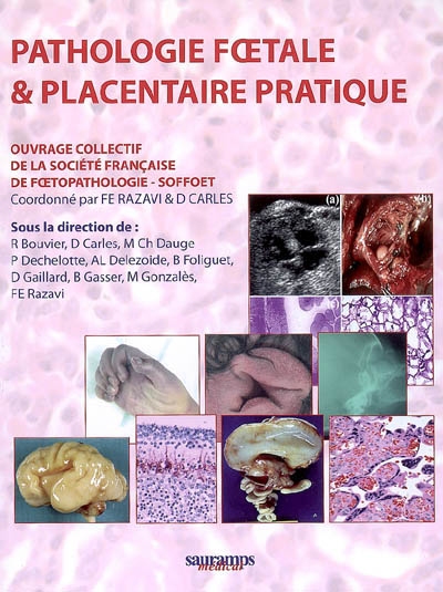 Pathologie foetale & placentaire pratique