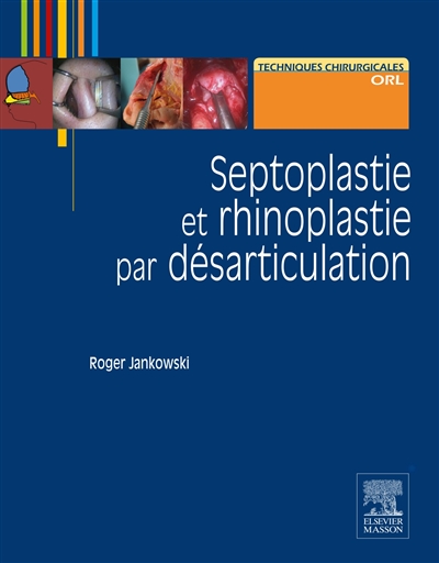 Septoplastie et rhinoplastie par désarticulation : histoire, anatomie, chirurgie et architecture naturelle du nez