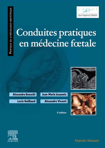 Conduites pratiques en médecine foetale