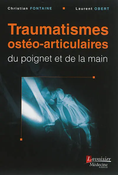 Traumatismes ostéo-articulaires du poignet et de la main