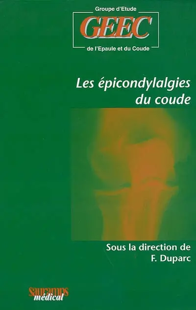 Les épicondylalgies du coude