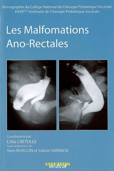Les malformations ano-rectales
