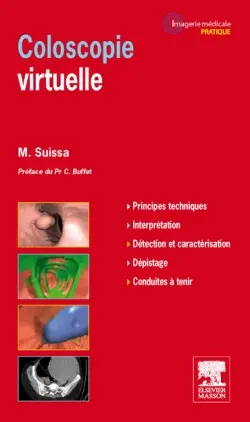 Coloscopie virtuelle