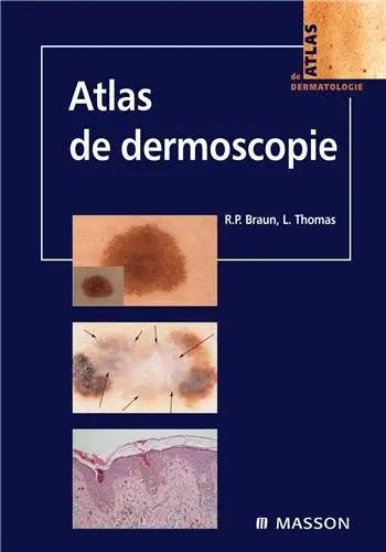Atlas de dermoscopie