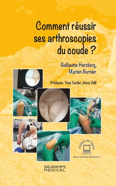 comment réussir ses arthroscopies du coude?