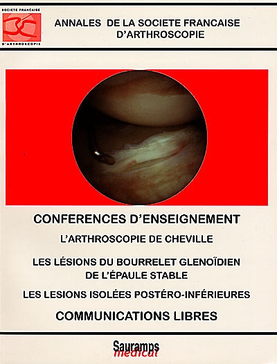 Conférences d'enseignement de la Société française d'arthroscopie : l'arthroscopie de cheville, les lésions du bourrelet glenoïdien de l'épaule stable, lésions isolées postero-inférieures, communications libres