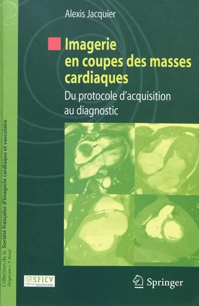 Imagerie en coupes des masses cardiaques : du protocole d'acquisition au diagnostic