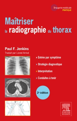 Maîtriser la radiographie du thorax : guide pratique
