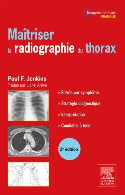 Maîtriser la radiographie du thorax : guide pratique