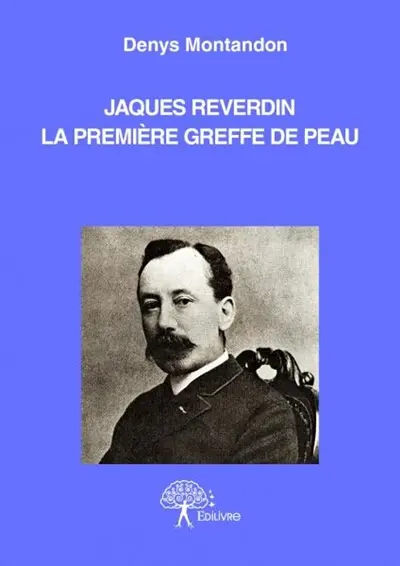 Jacques reverdin, la première greffe de peau : ou La Genèse d’une découverte médicale