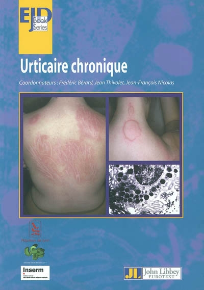 Urticaire chronique : séminaire thématique de la Coordination d'allergologie du CHU de Lyon