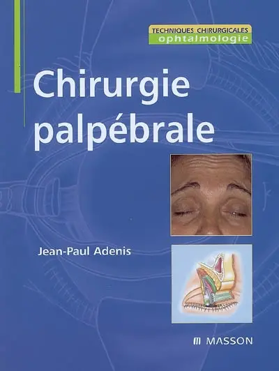 Chirurgie palpébrale