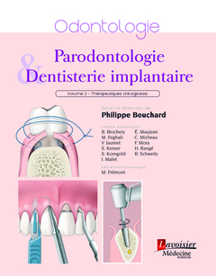 Parodontologie & dentisterie implantaire. Vol. 2. Thérapeutiques chirurgicales