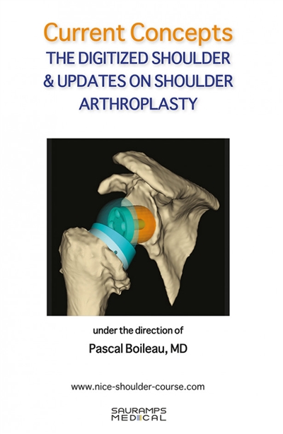 The digitized shoulder & updates on shoulder arthroplasty : current concepts