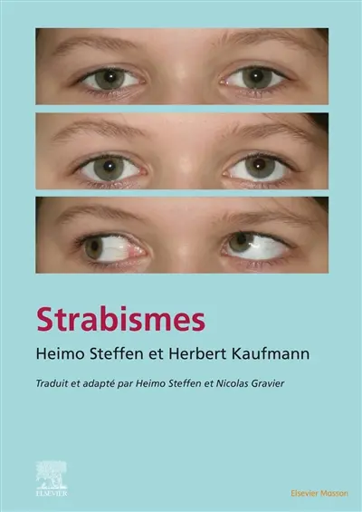 Strabismes