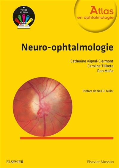 Neuro-ophtalmologie