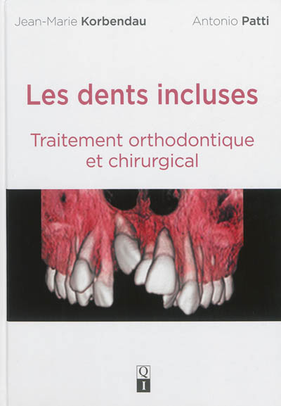 Les dents incluses : traitement orthodontique et chirurgical