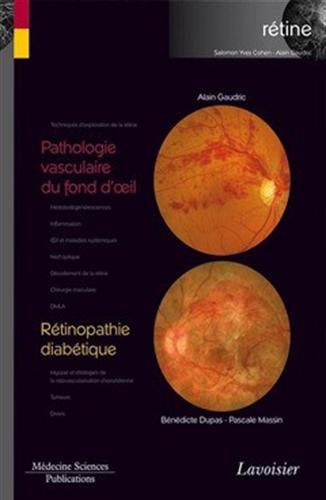 Rétine. Vol. 3. Pathologie vasculaire du fond d'oeil, rétinopathie diabétique