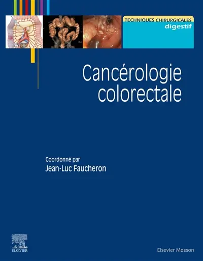 Cancérologie colorectale