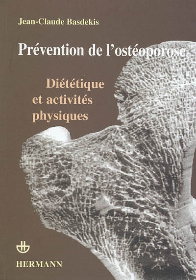 Prévention de l'ostéoporose : diététique et activités physiques