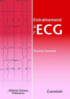 Entraînement à l'ECG : 259...
