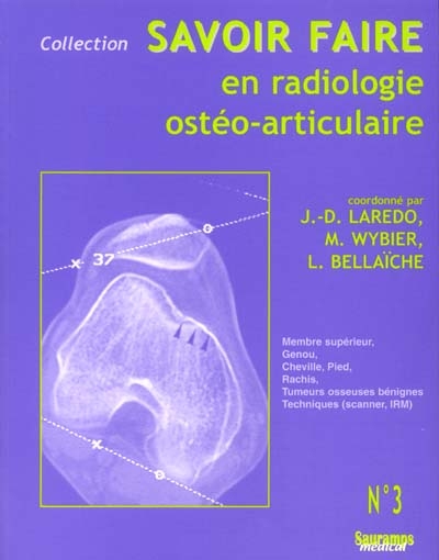 Savoir faire en radiologie ostéo-articulaire. Vol. 3. Membre supérieur, genou, cheville, pied, rachis, tumeurs osseuses bénignes, techniques de scanner et d'IRM