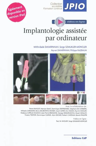 Implantologie assistée par ordinateur